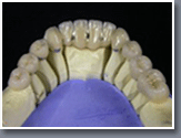 ceramill